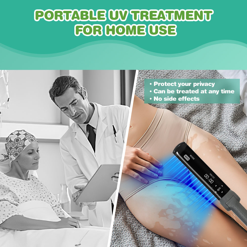 UVB lampa Kernel KN-4003BL 311nm na lupénku a vitiligo
