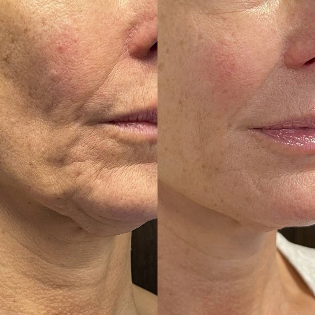 Stick sérum anti-âge Nexa — Soin raffermissant aux triples peptides