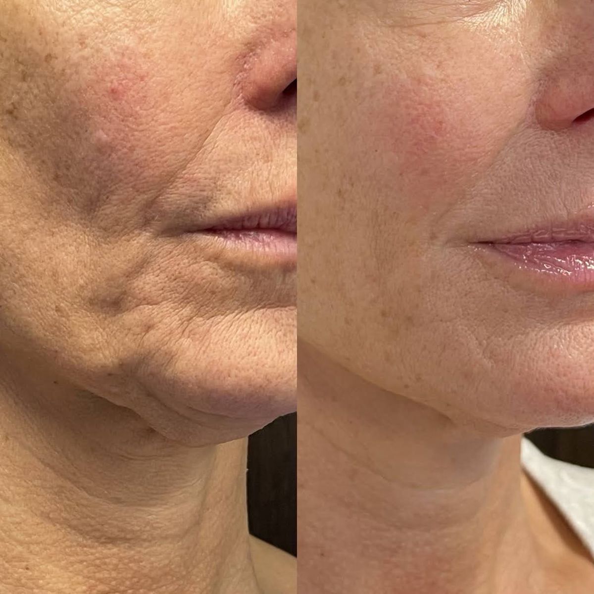 Stick sérum anti-âge Nexa — Soin raffermissant aux triples peptides