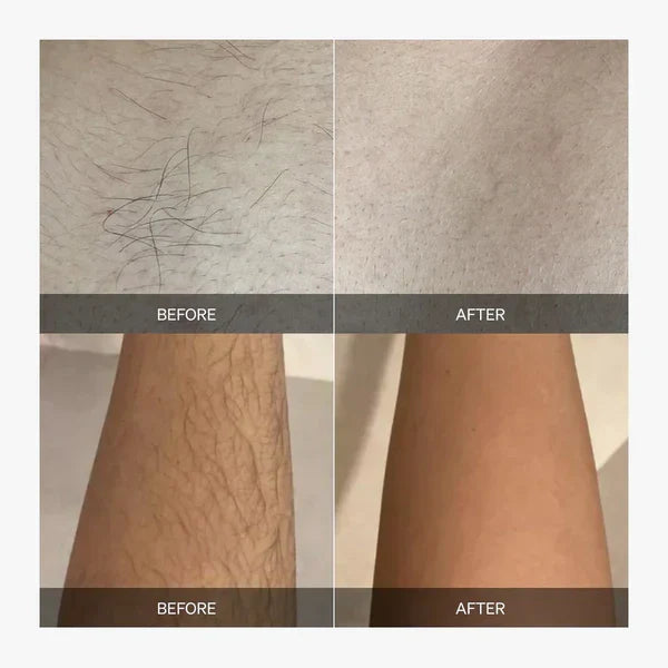 GlowPulse Full-Body Hair Removal — Smooth Skin, Zero Irritation