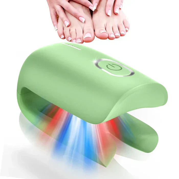 Sistema de terapia láser para los hongos de las uñas LuminNail — 905 nm y 470 nm