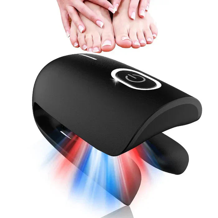 Sistema de terapia láser para los hongos de las uñas LuminNail — 905 nm y 470 nm