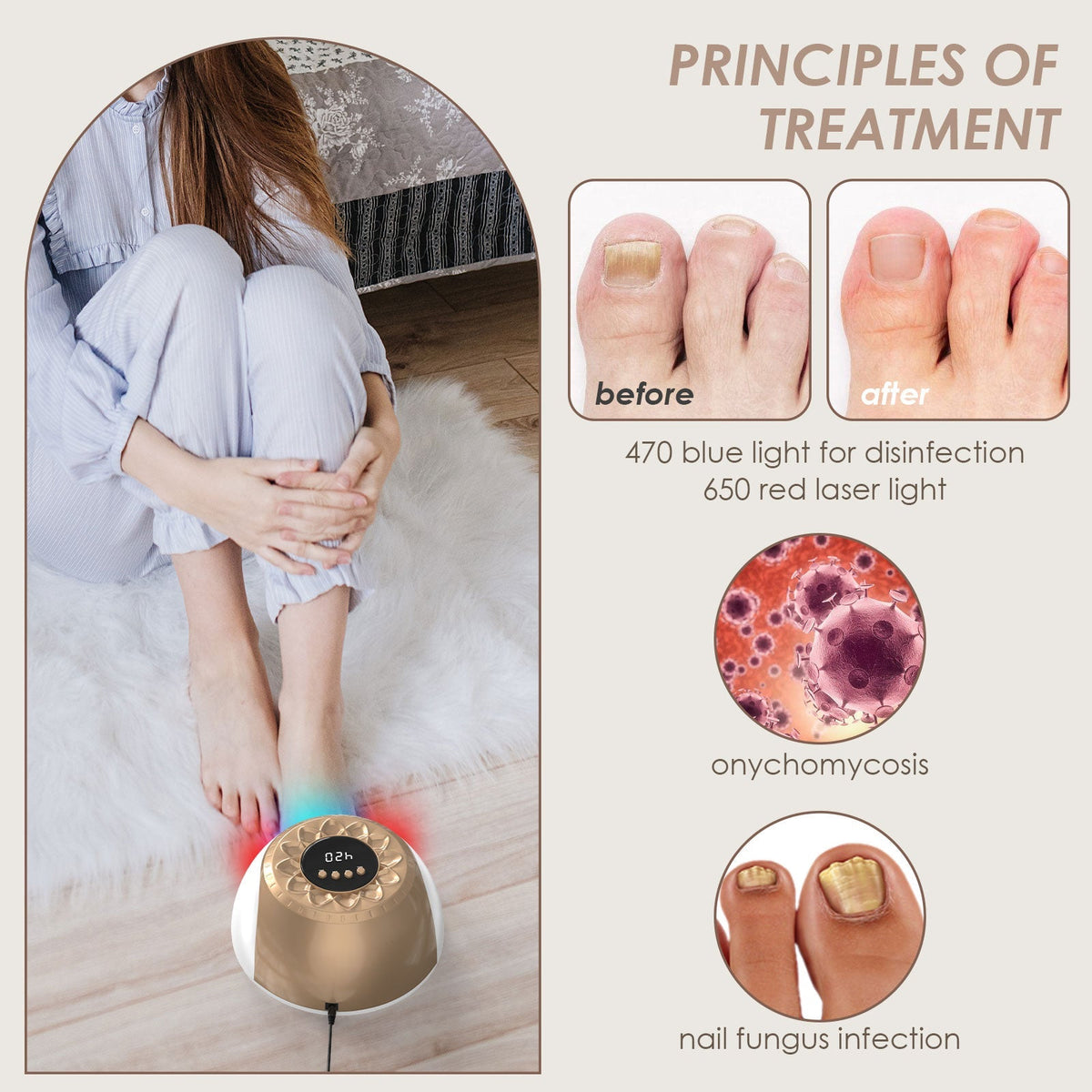 Aurora Gold-licht tegen nagelschimmel — behandeling van meerdere teennagels