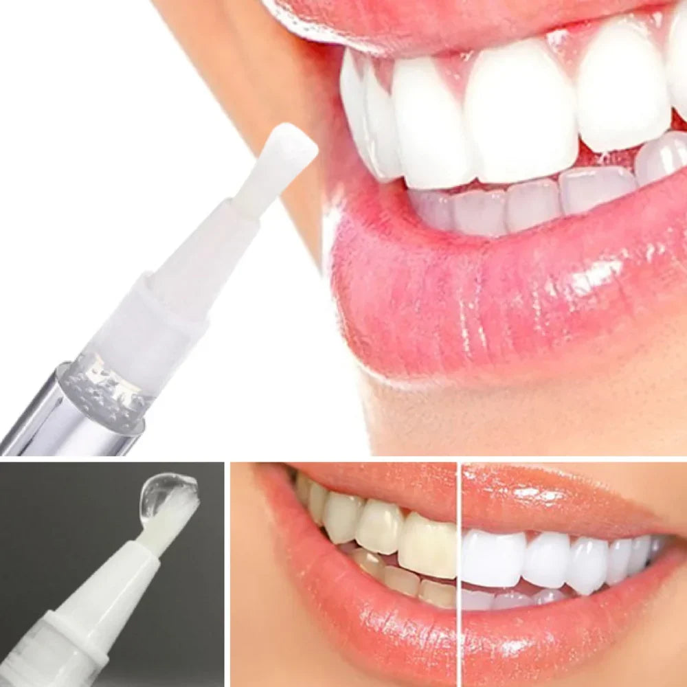 Color-Correcting Teeth Whitening Pen — Daily Brightening Care
