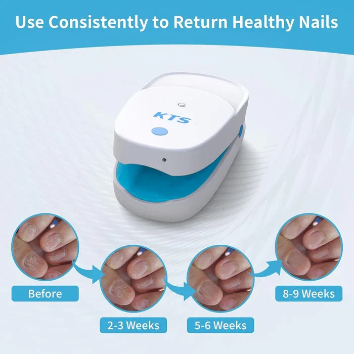 Sistema de terapia láser para los hongos de las uñas LuminNail — 905 nm y 470 nm