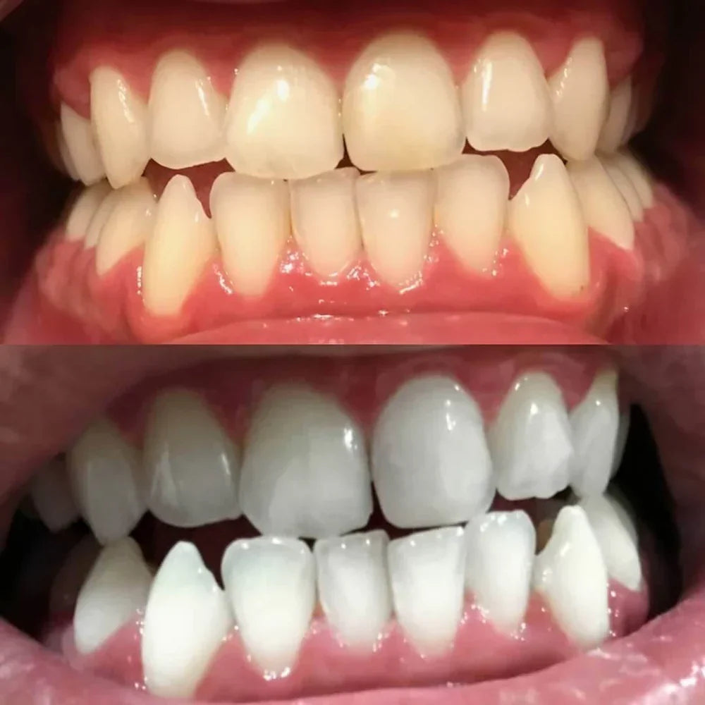 Color-Correcting Teeth Whitening Pen — Daily Brightening Care
