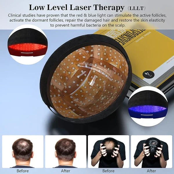 Čepice pro obnovu růstu vlasů pomocí laseru 1.0 - laserová terapie s nízkou intenzitou