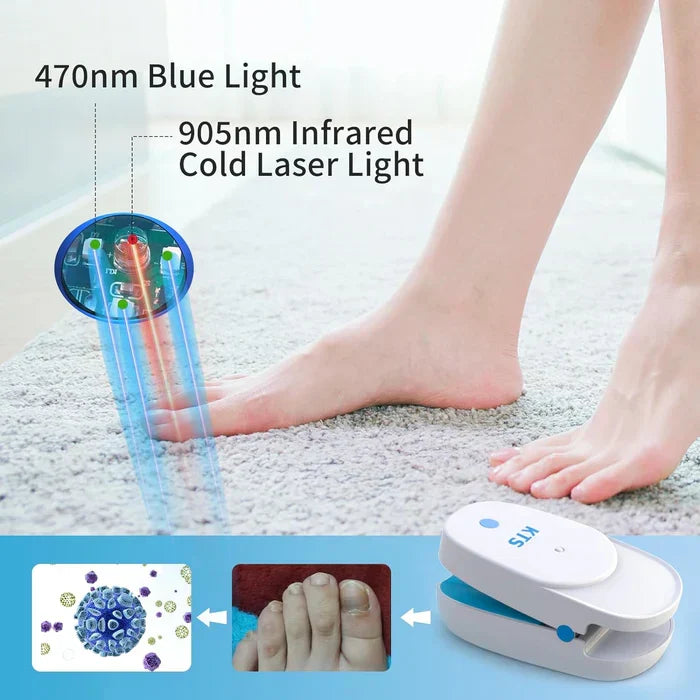 NovaPulse Dual-Wavelength Nail Fungus Laser Devices Starter Kit