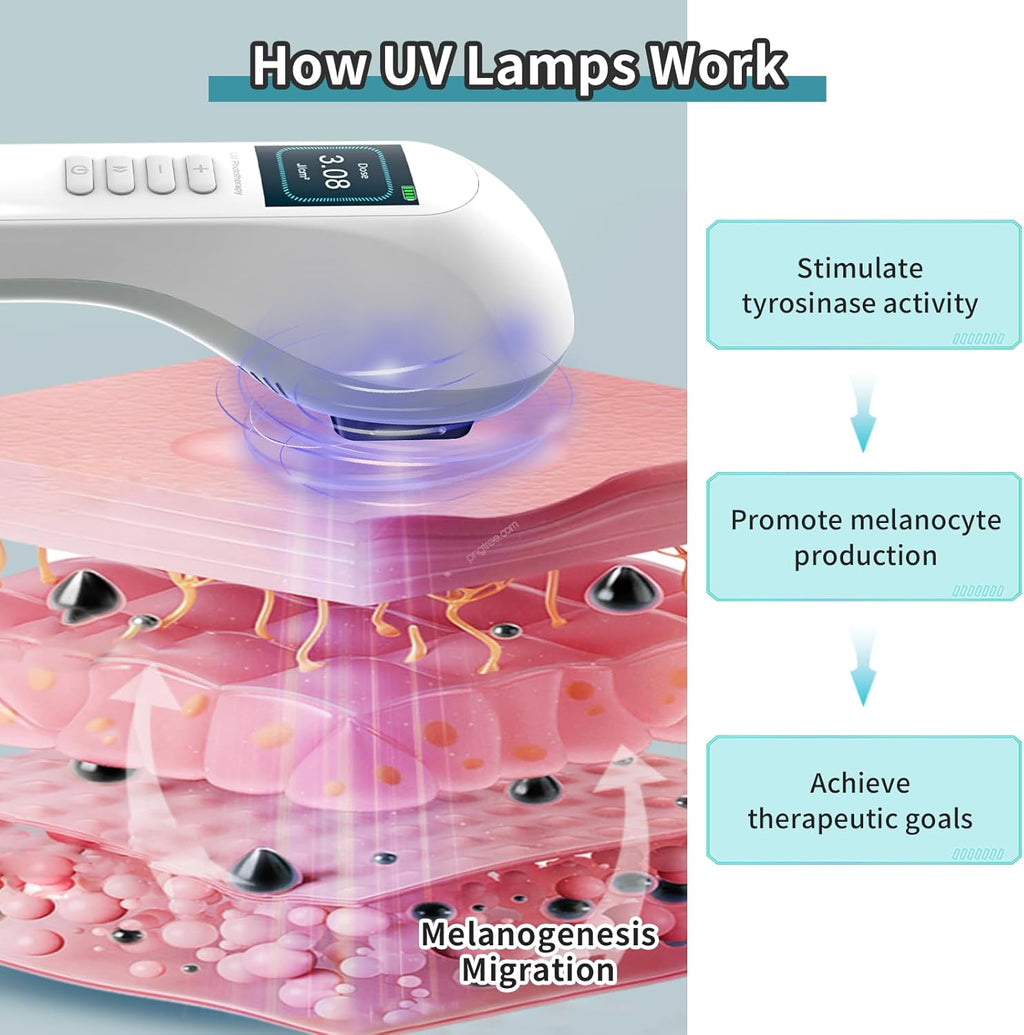 308nm-uv-lichtfototherapielamp met leds — compact en draagbaar ontwerp
