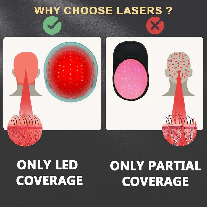 Laser Cap Hair Regrowth System — 650 nm Red Light Therapy