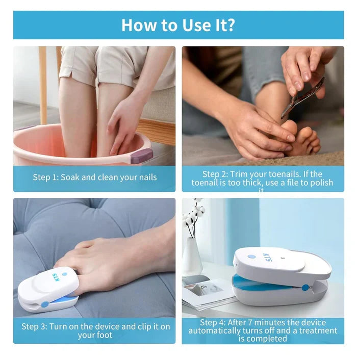 Sistema de terapia láser para los hongos de las uñas LuminNail — 905 nm y 470 nm