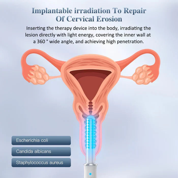 Přenosný vaginální omlazovací přístroj — světlo a vibrace