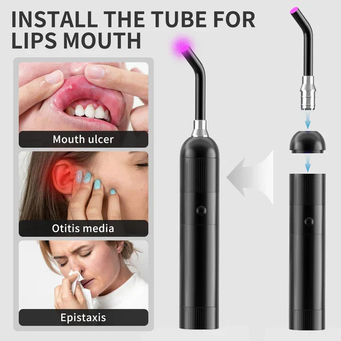 Dispositivo AuroraBeam per terapia orale a luce rossa — portatile 3-in-1
