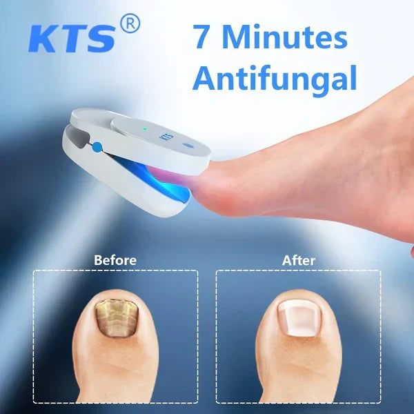 NovaPulse Dual-Wavelength Nail Fungus Laser Devices Starter Kit
