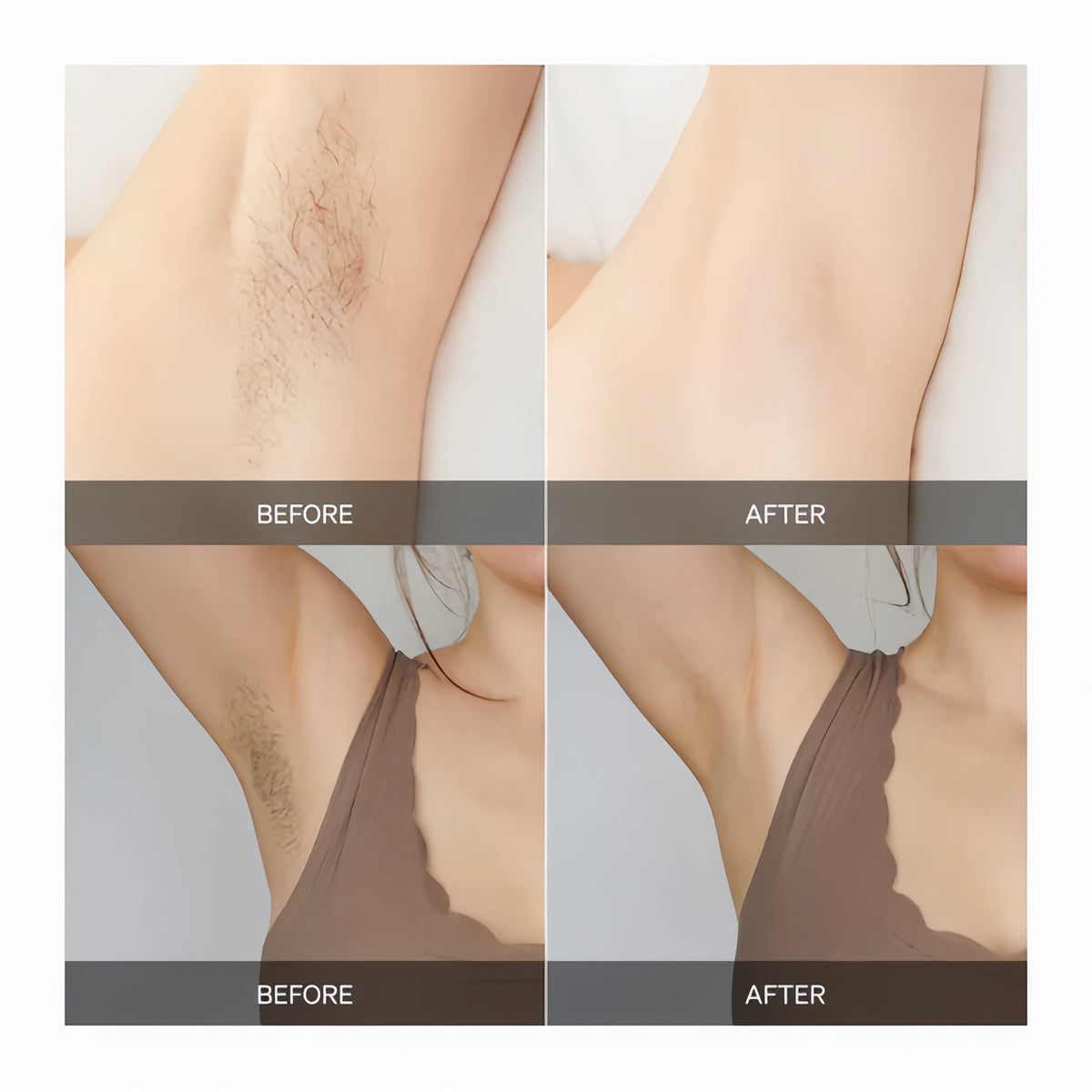 GlowPulse Full-Body Hair Removal — Smooth Skin, Zero Irritation