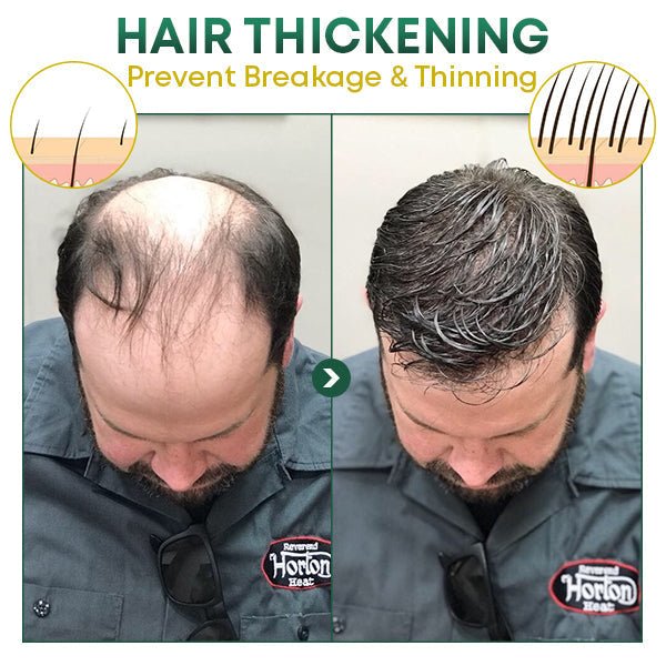Natural Hair Enhancer for Thicker Growth | livraina