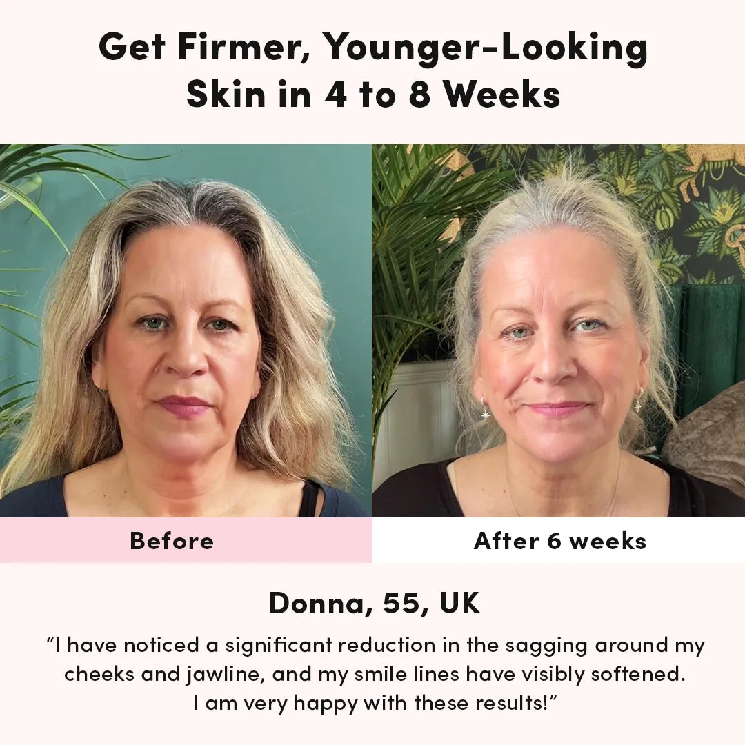 NovaGlow RegenMask Maska LED na twarz i szyję — 192 diody LED