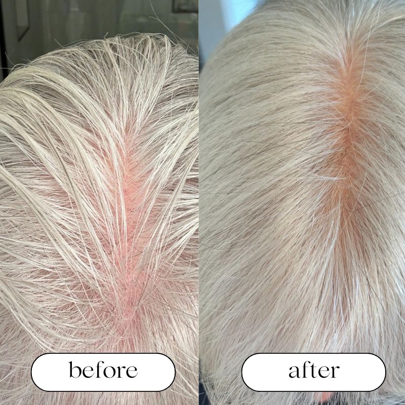 Hair Growth Red Light Therapy Cap — Scalp Care, Fuller Hair