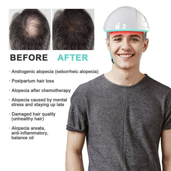 Laser Cap Hair Regrowth System — 650 nm Red Light Therapy