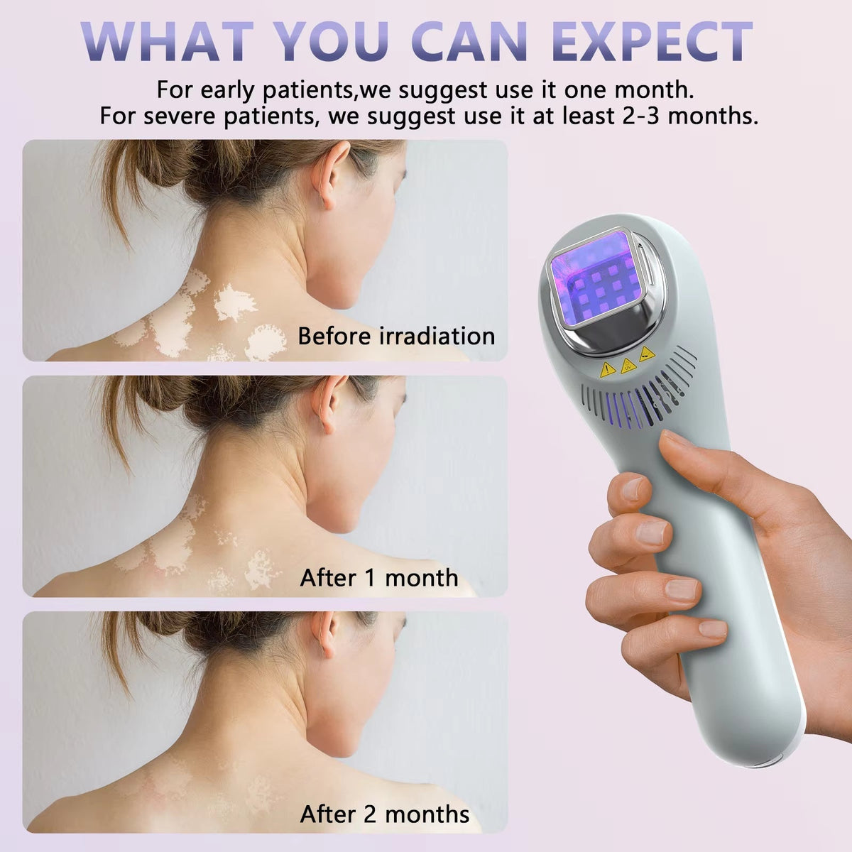 Lampada per fototerapia UVB 308 Nm — 3-in-1 per viso, collo e arti