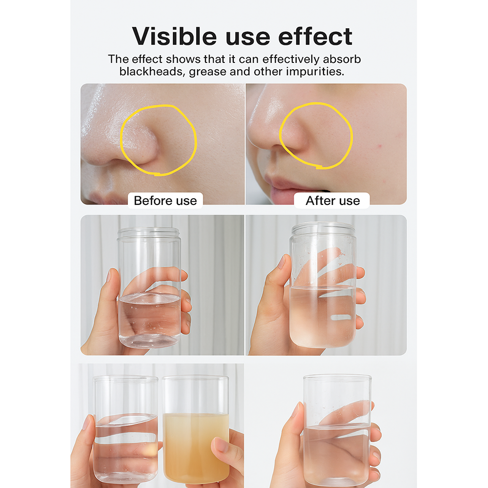 Macchina estetica per il viso Aqua Peel con bolle di ossigeno e idrogeno
