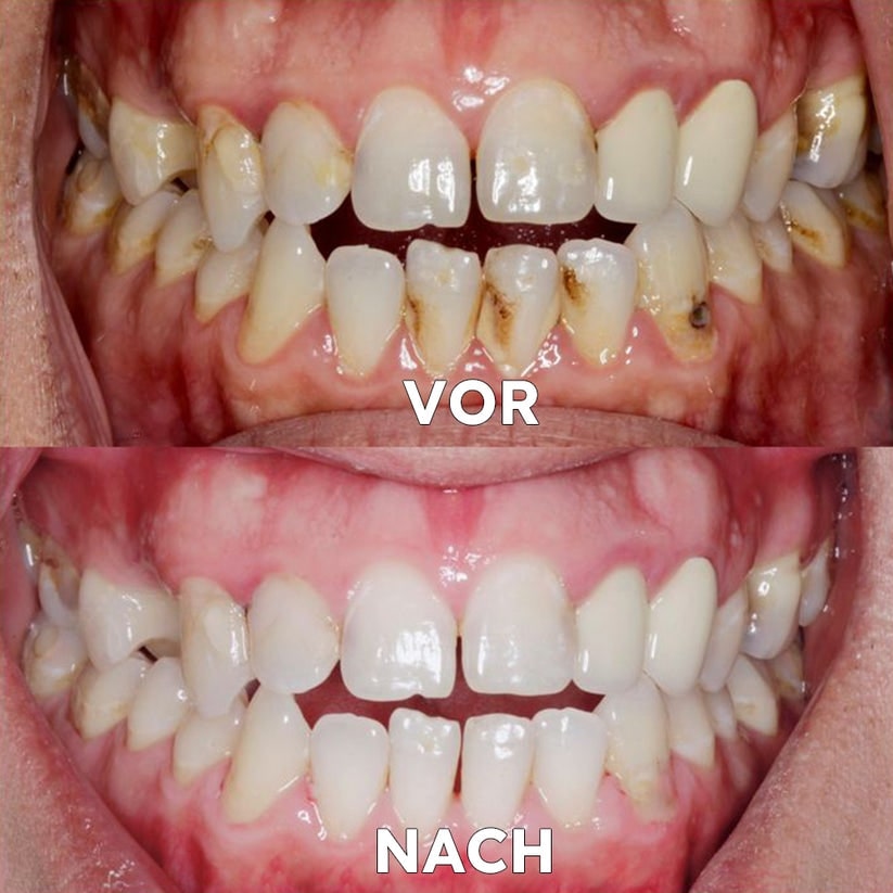 Natural Mineral Powder for Dental Care - Strengthen & Protect Your Smile | livraina