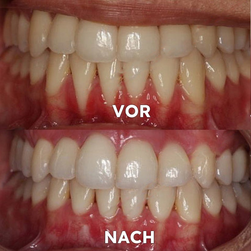 Natural Mineral Powder for Dental Care - Strengthen & Protect Your Smile | livraina