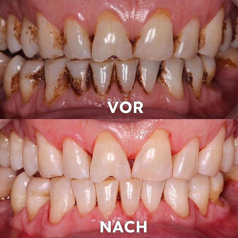 Natural Mineral Powder for Dental Care - Strengthen & Protect Your Smile | livraina