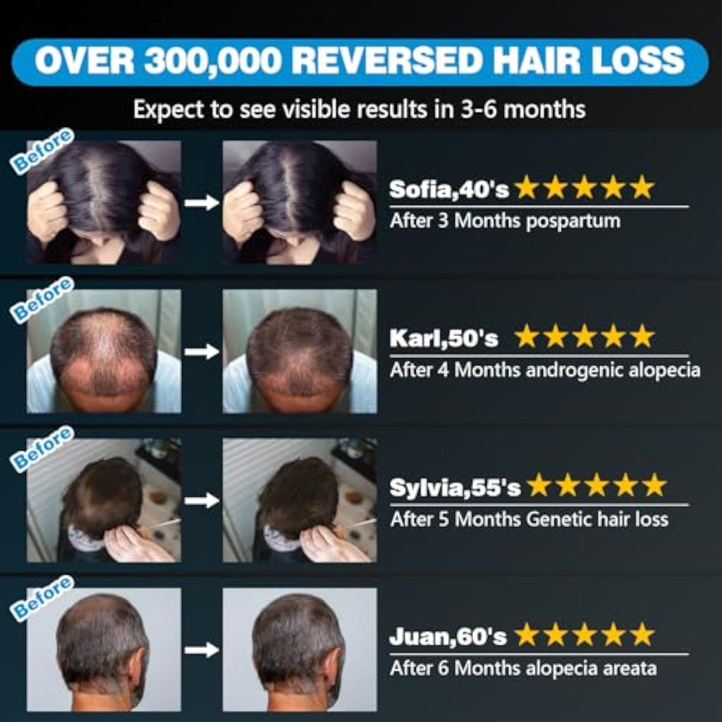כובע לייזר מקצועי להצמחת שיער מחדש, מהדורת Pro 1.0 — LLLT באורך גל כפול